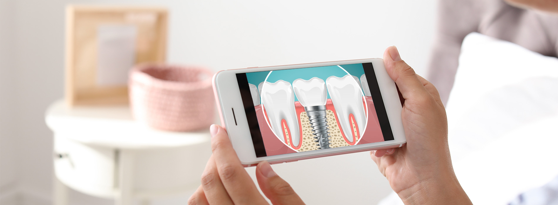 Concho Valley Family Dental | Night Guards, Dental Bridges and Veneers