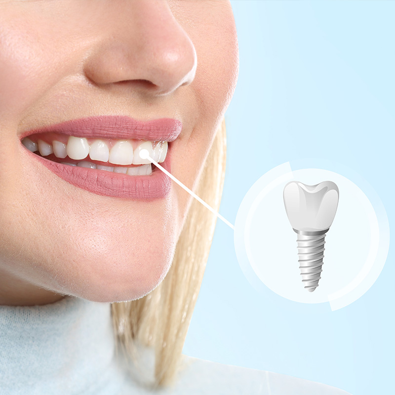 Concho Valley Family Dental | Dentures, Dental Bridges and Dental Fillings
