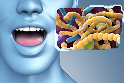 Concho Valley Family Dental | Dental Fillings, Night Guards and Dental Bridges
