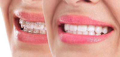 Concho Valley Family Dental | Dental Fillings, Implant Dentistry and Periodontal Treatment