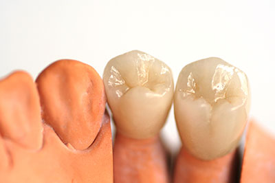 Concho Valley Family Dental | Sedation Dentistry, Veneers and Preventative Program