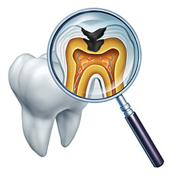 Concho Valley Family Dental | Cosmetic Dentistry, Nitrous Oxide Sedation and Sedation Dentistry
