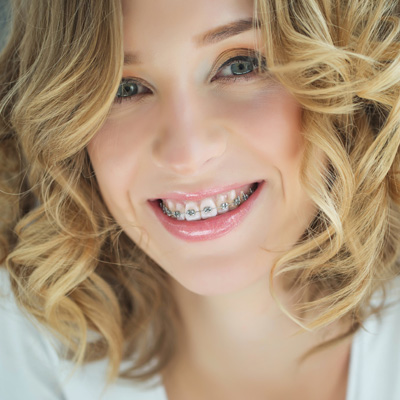 Concho Valley Family Dental | Nitrous Oxide Sedation, Crowns  amp  Caps and Cosmetic Dentistry