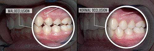 Concho Valley Family Dental | Dental Fillings, Oral Exams and Dental Bridges