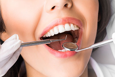 Concho Valley Family Dental | Night Guards, Veneers and Dental Fillings