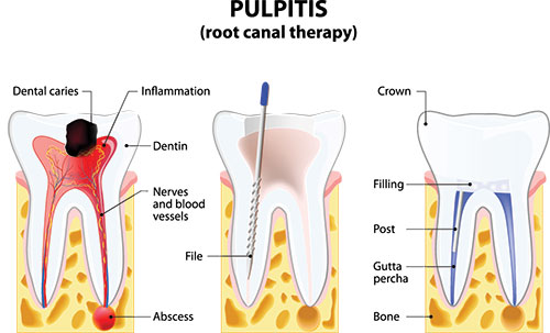 Concho Valley Family Dental | Cosmetic Dentistry, Teeth Whitening and Implant Dentistry