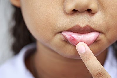 Concho Valley Family Dental | Sedation Dentistry, Dental Fillings and Cosmetic Dentistry
