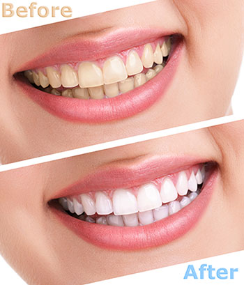 Concho Valley Family Dental | Implant Dentistry, Dentures and Nitrous Oxide Sedation