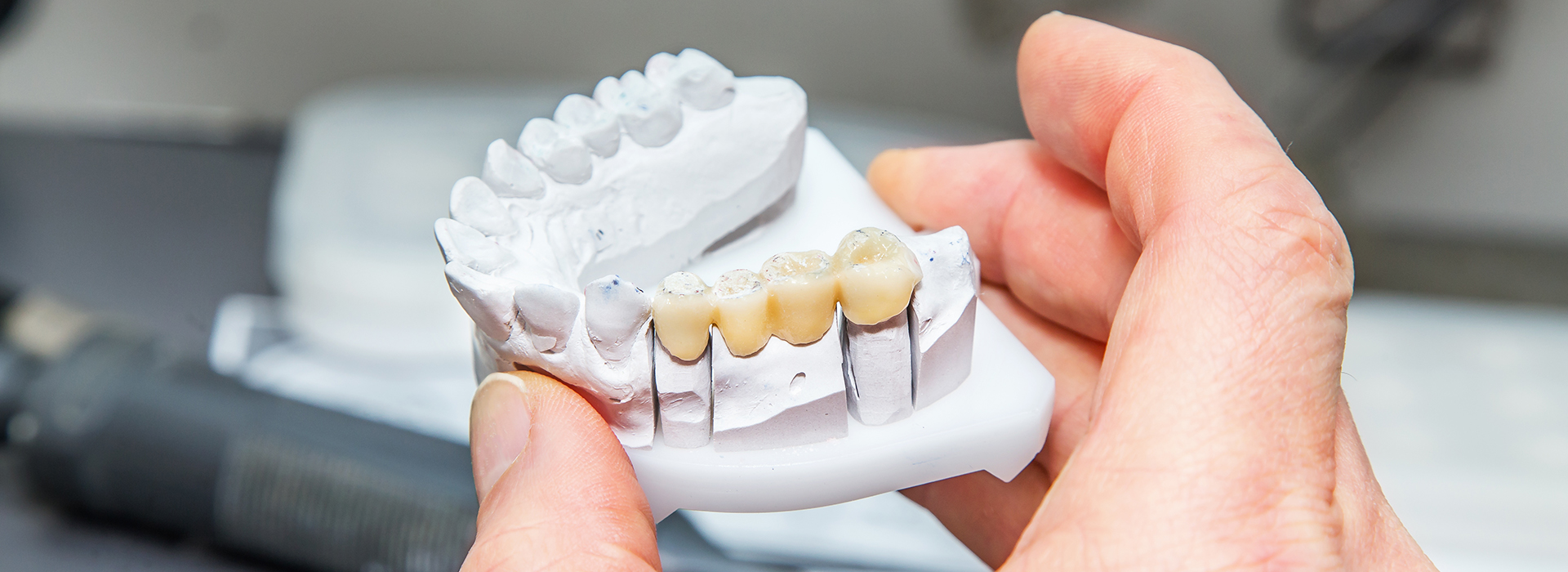 Concho Valley Family Dental | Nitrous Oxide Sedation, Oral Exams and Periodontal Treatment