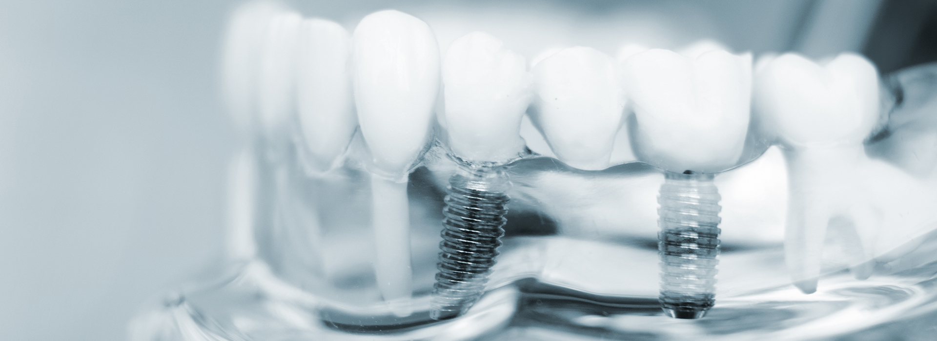 Concho Valley Family Dental | Night Guards, Cosmetic Dentistry and Sedation Dentistry