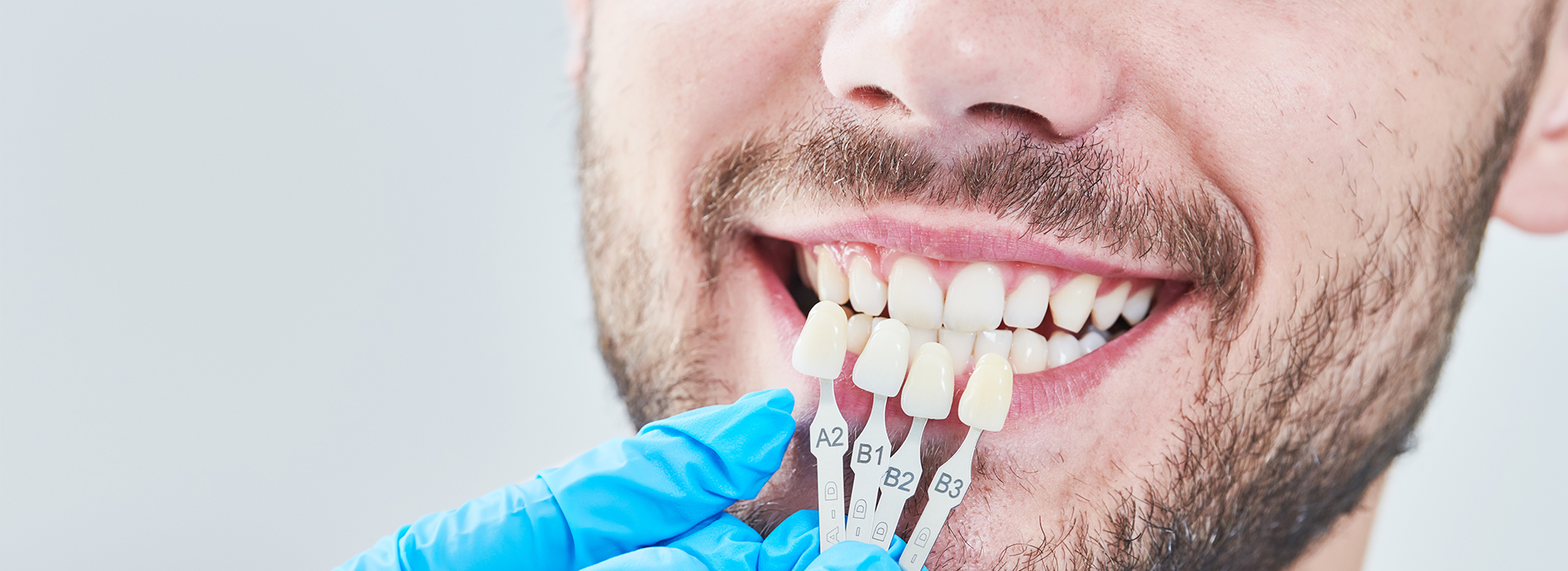 Concho Valley Family Dental | Dental Fillings, Nitrous Oxide Sedation and Crowns  amp  Caps