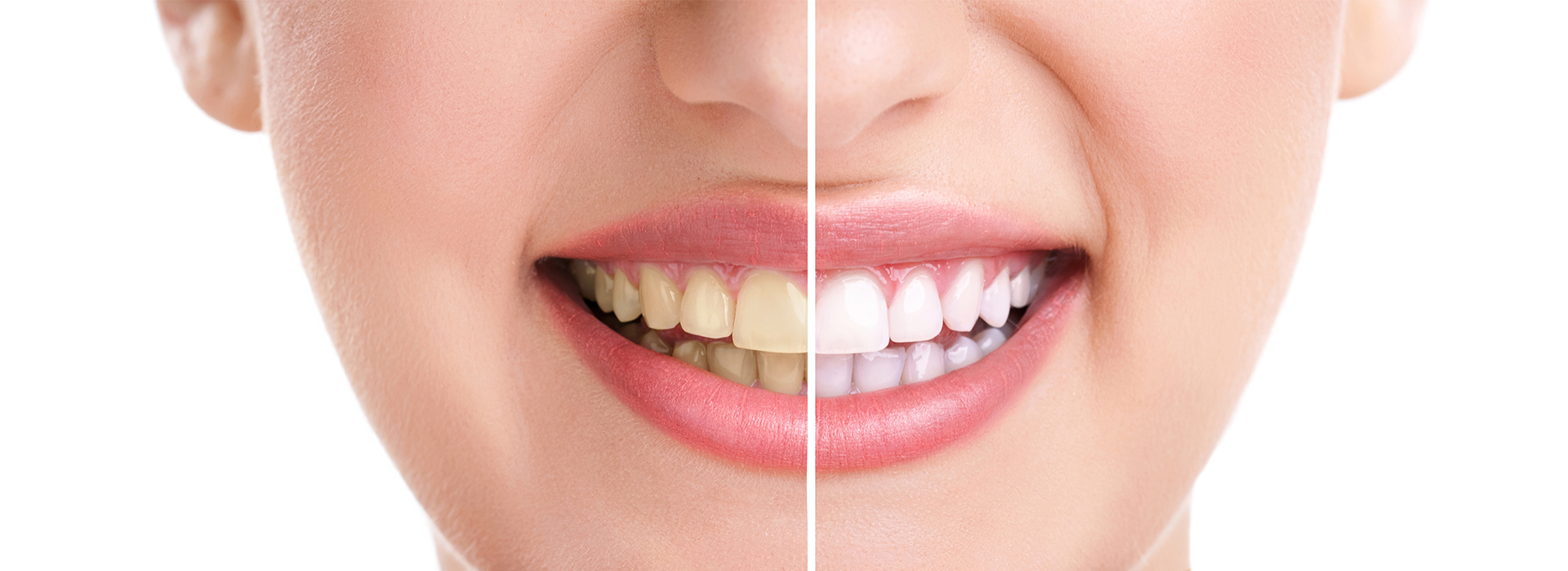 Concho Valley Family Dental | Oral Exams, Night Guards and Dentures