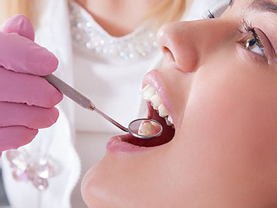 Concho Valley Family Dental | Oral Exams, Wisdom Teeth Extractions and Teeth Whitening